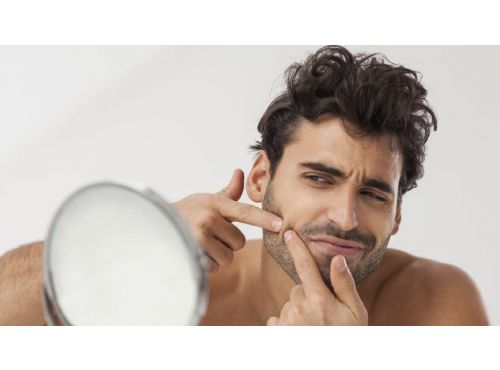 علاج حب الشباب