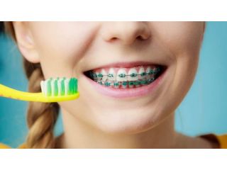 أضرار تقويم الأسنان